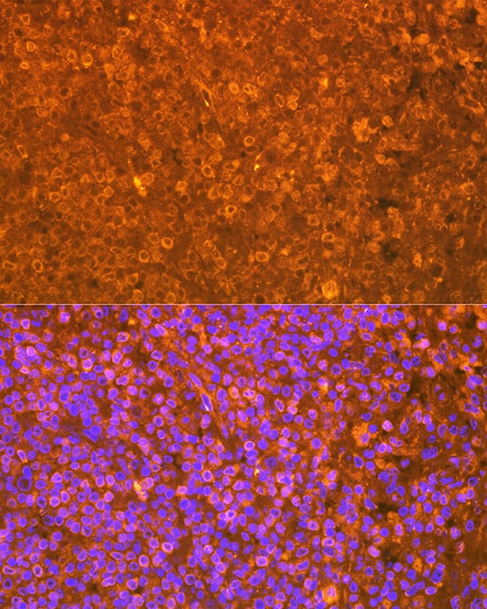 Immunocytochemistry/ Immunofluorescence: EBI3 Antibody (9J1H4) [EBI3] - Immunofluorescence analysis of paraffin-embedded human spleen using EBI3 Rabbit mAb  at dilution of 1:100 (40x lens). Secondary antibody: Cy3-conjugated Goat anti-Rabbit IgG (H+L)  at 1:500 dilution. Blue: DAPI for nuclear staining.