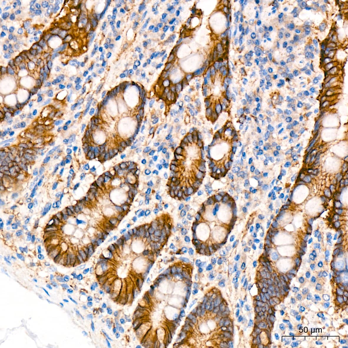 Immunohistochemistry: CTNNA3 Antibody (8F1U7) [NBP3-15741] - Immunohistochemistry analysis of CTNNA3 in paraffin-embedded human colon tissue using CTNNA3 Rabbit mAb  at a dilution of 1:200 (40x lens). High pressure antigen retrieval was performed with 0.01 M citrate buffer (pH 6.0) prior to IHC staining.