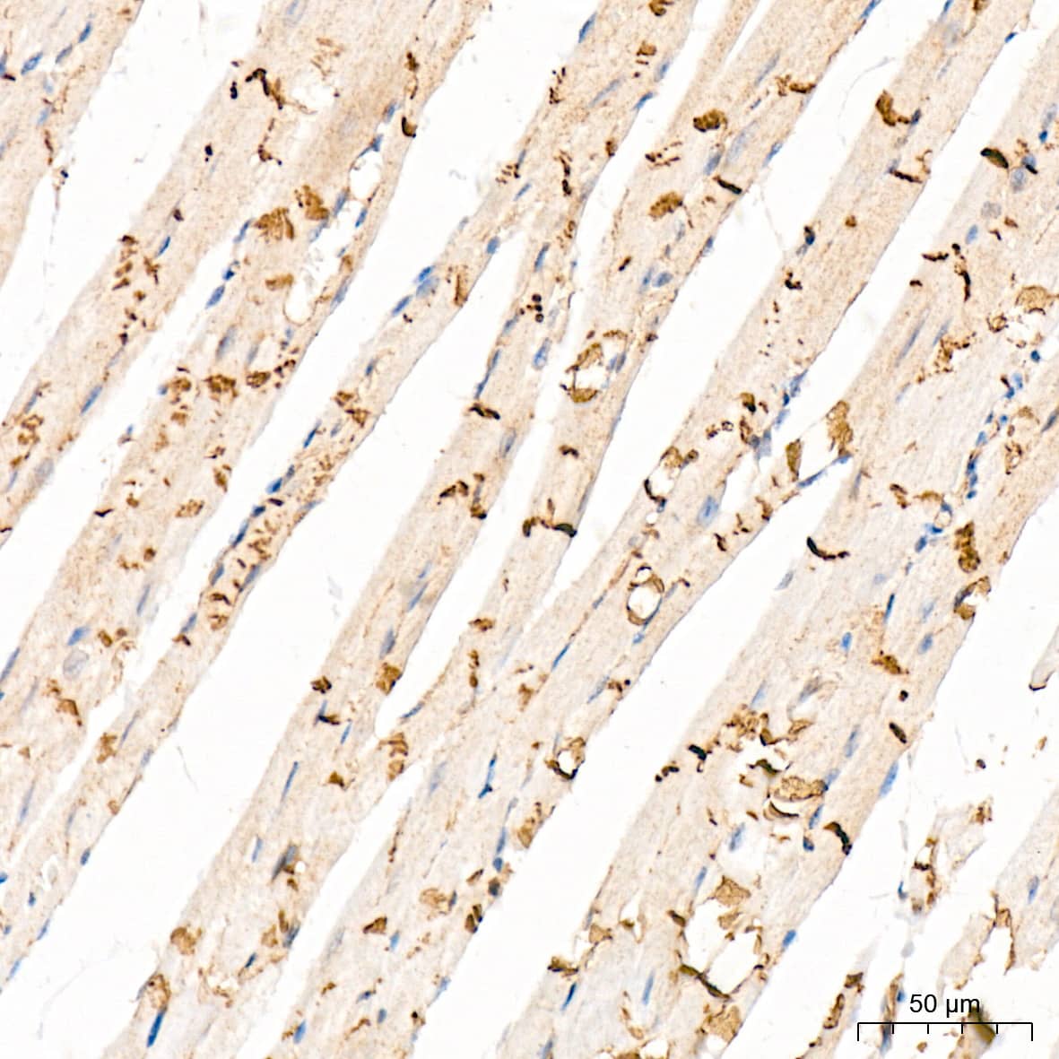 Immunohistochemistry: CTNNA3 Antibody (8F1U7) [NBP3-15741] - Immunohistochemistry analysis of CTNNA3 in paraffin-embedded mouse heart tissue using CTNNA3 Rabbit mAb  at a dilution of 1:200 (40x lens). High pressure antigen retrieval was performed with 0.01 M citrate buffer (pH 6.0) prior to IHC staining.