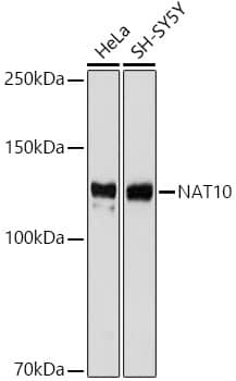 Western Blot: NAT10 Antibody (5Z3E5) [NAT10] - Western blot analysis of various lysates using NAT10 Rabbit mAb  at 1:1000 dilution.Secondary antibody: HRP-conjugated Goat anti-Rabbit IgG (H+L)  at 1:10000 dilution.Lysates/proteins: 25ug per lane.Blocking buffer: 3% nonfat dry milk in TBST.Detection: ECL Basic Kit .Exposure time: 3s.