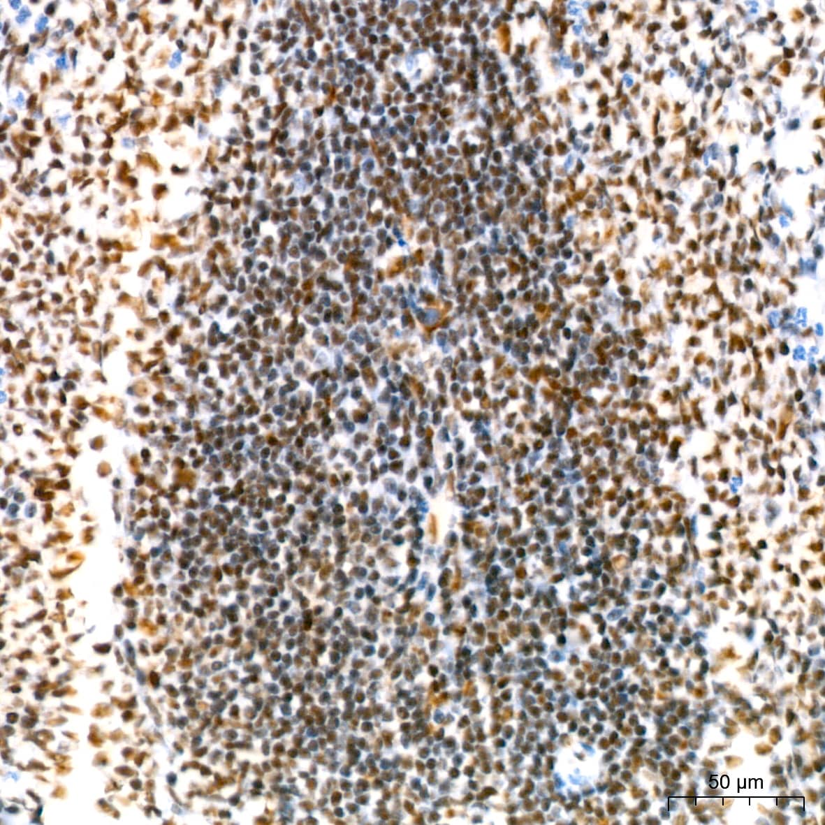 Immunohistochemistry: NAT10 Antibody (5Z3E5) [NAT10] - Immunohistochemistry analysis of paraffin-embedded Rat spleen using NAT10 Rabbit mAb  at dilution of 1:200 (40x lens). High pressure antigen retrieval performed with 0.01M Tris/EDTA Buffer (pH 9.0) prior to IHC staining.