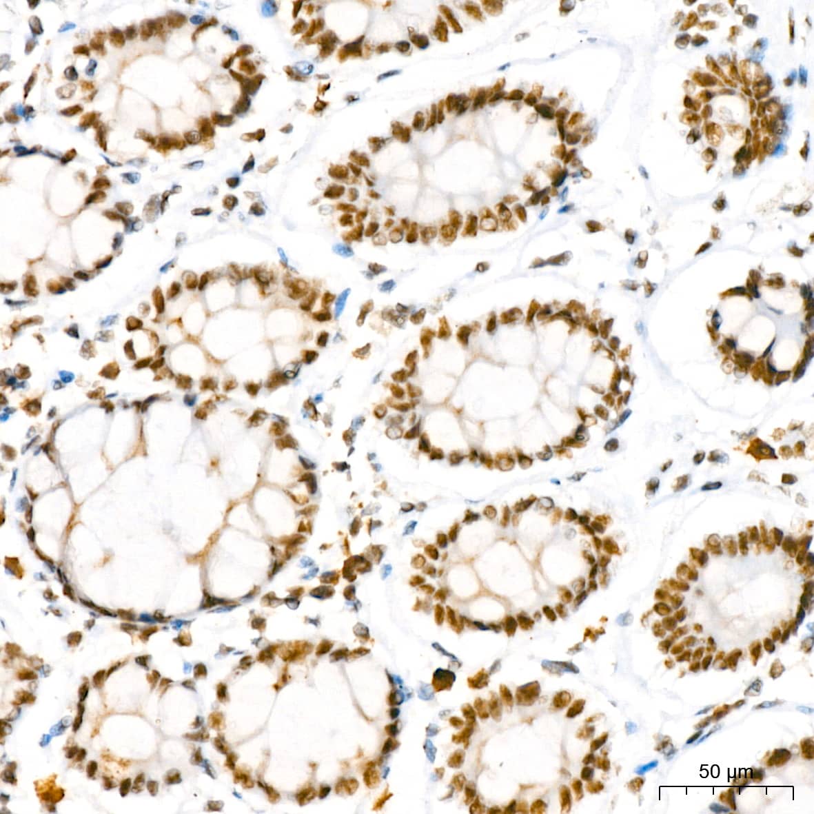 Immunohistochemistry: NAT10 Antibody (5Z3E5) [NAT10] - Immunohistochemistry analysis of paraffin-embedded Human colon using NAT10 Rabbit mAb  at dilution of 1:200 (40x lens). High pressure antigen retrieval performed with 0.01M Tris/EDTA Buffer (pH 9.0) prior to IHC staining.