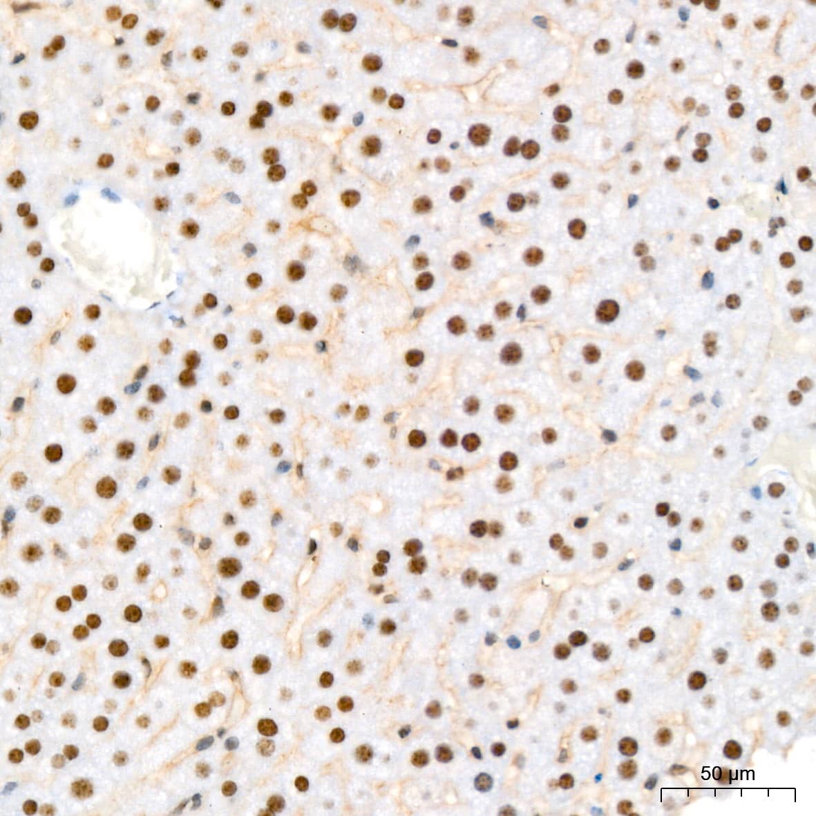 Immunohistochemistry NAT10 Antibody (5Z3E5)