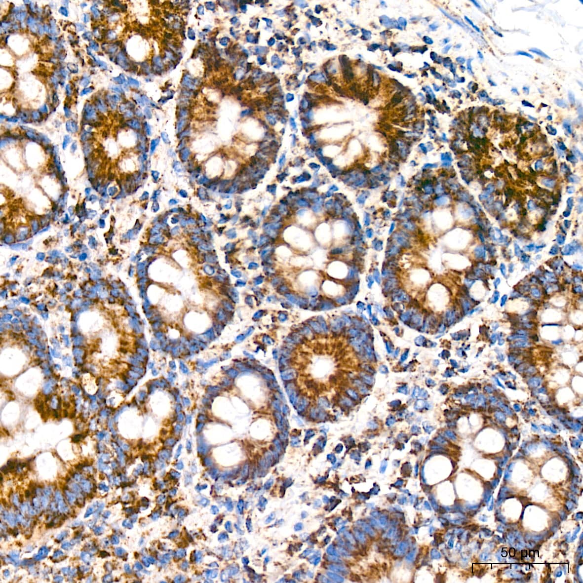 Immunohistochemistry Bcl G Antibody (6R9F3)