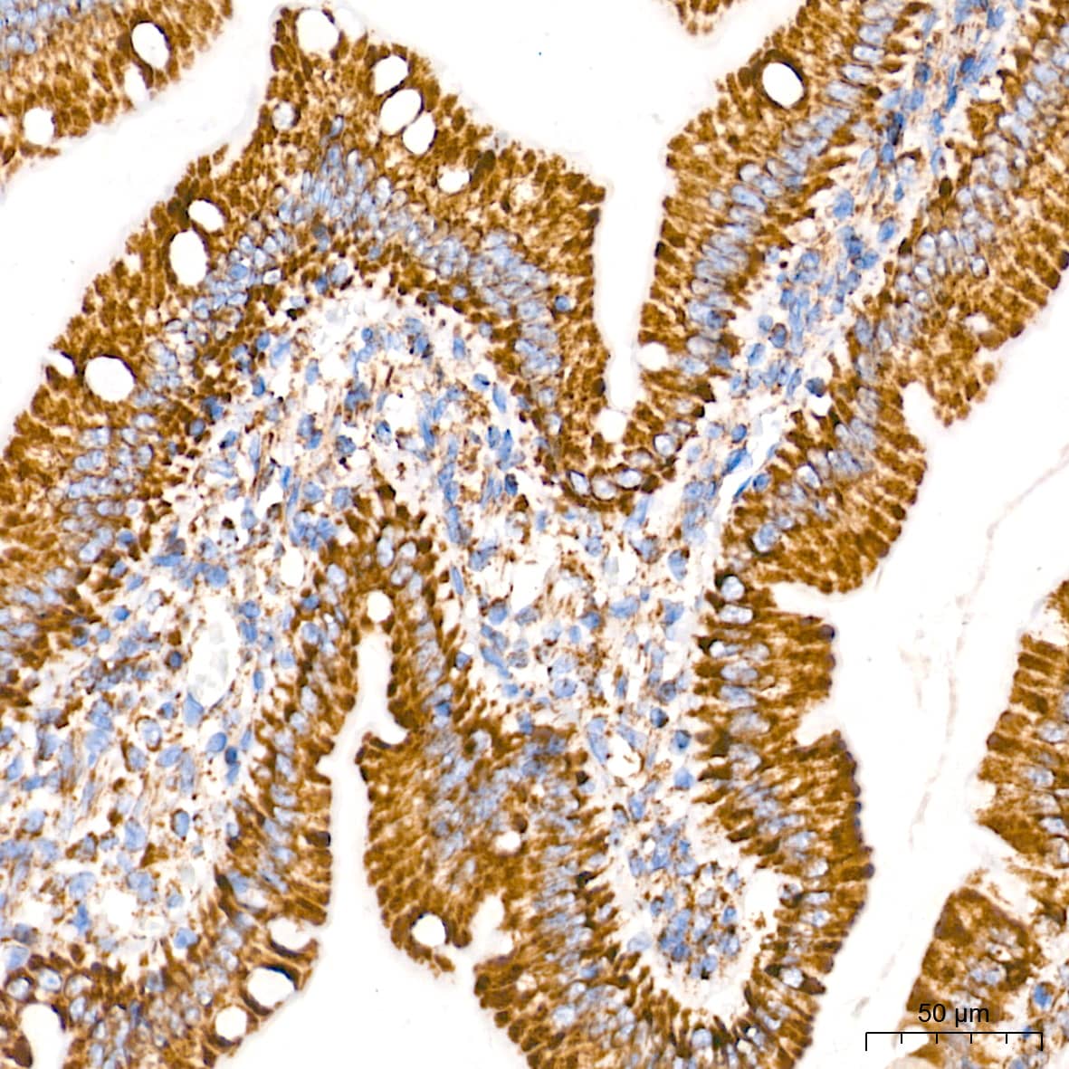Immunohistochemistry: TOMM20 Antibody (10G6I8) [TOMM20] - Immunohistochemistry analysis of paraffin-embedded Rat intestine tissue using TOMM20 Rabbit mAb  at a dilution of 1:5000 (40x lens). High pressure antigen retrieval performed with 0.01M Tris-EDTA Buffer (pH 9.0) prior to IHC staining.