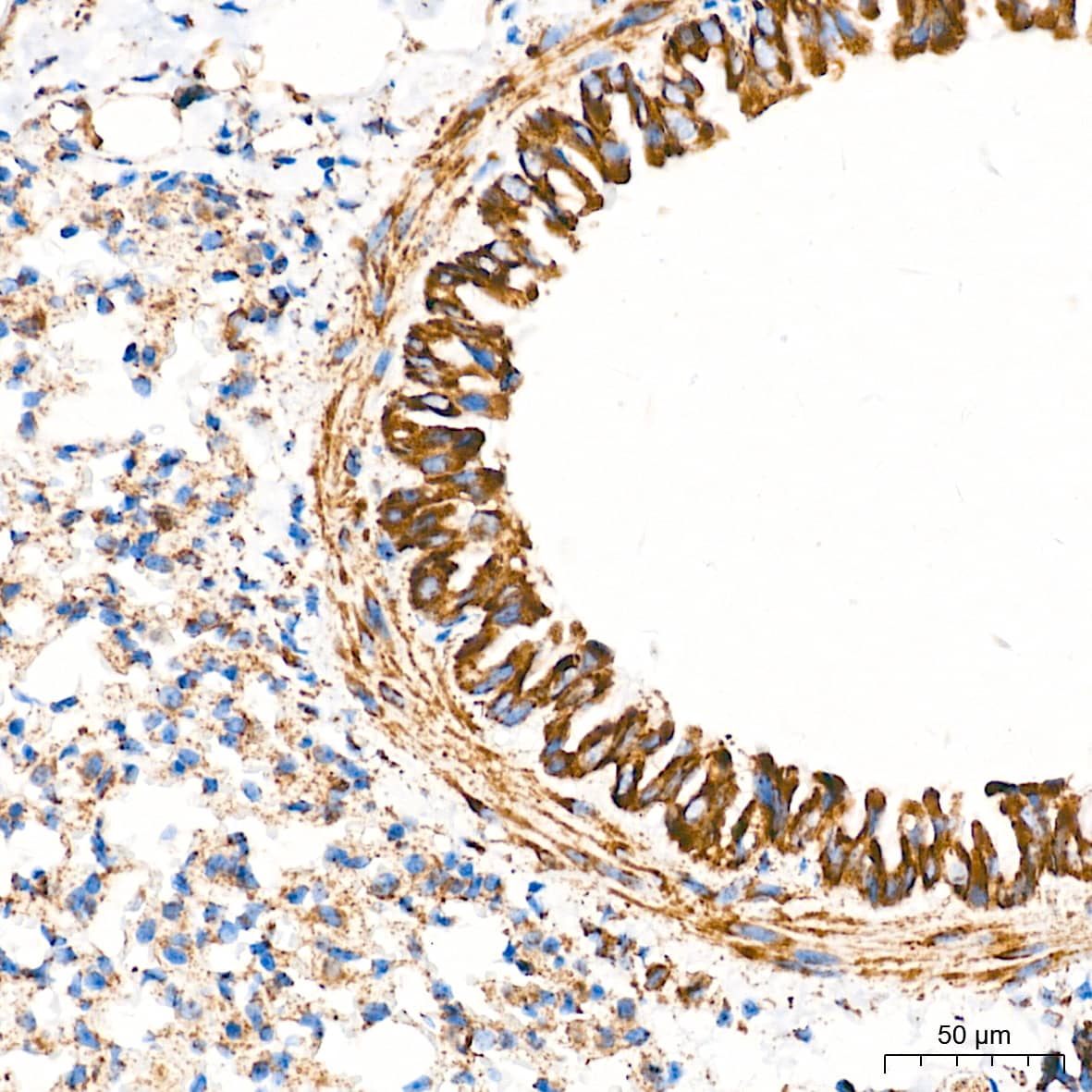 Immunohistochemistry: TOMM20 Antibody (10G6I8) [TOMM20] - Immunohistochemistry analysis of paraffin-embedded Mouse lung tissue using TOMM20 Rabbit mAb  at a dilution of 1:5000 (40x lens). High pressure antigen retrieval performed with 0.01M Tris-EDTA Buffer (pH 9.0) prior to IHC staining.