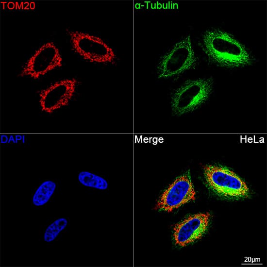 Immunocytochemistry/ Immunofluorescence: TOMM20 Antibody (10G6I8) [TOMM20] - Confocal imaging of HeLa cells using TOMM20 Rabbit mAb  followed by a further incubation with Cy3 Goat Anti-Rabbit IgG (H+L)  . The cells were counterstained with alpha-Tubulin Mouse mAb  followed by incubation with ABflo 488-conjugated Goat Anti-Mouse IgG (H+L) Ab  (Green). DAPI was used for nuclear staining (Blue). Objective: 100x.