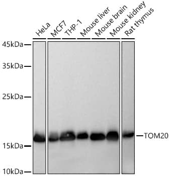 Western Blot: TOMM20 Antibody (10G6I8) [TOMM20] - Western blot analysis of various lysates using TOMM20 Rabbit mAb  at 1:5000 dilution incubated overnight at 4C.Secondary antibody: HRP-conjugated Goat anti-Rabbit IgG (H+L)  at 1:10000 dilution.Lysates/proteins: 25 ug per lane.Blocking buffer: 3% nonfat dry milk in TBST.Detection: ECL Basic Kit .Exposure time: 10s.
