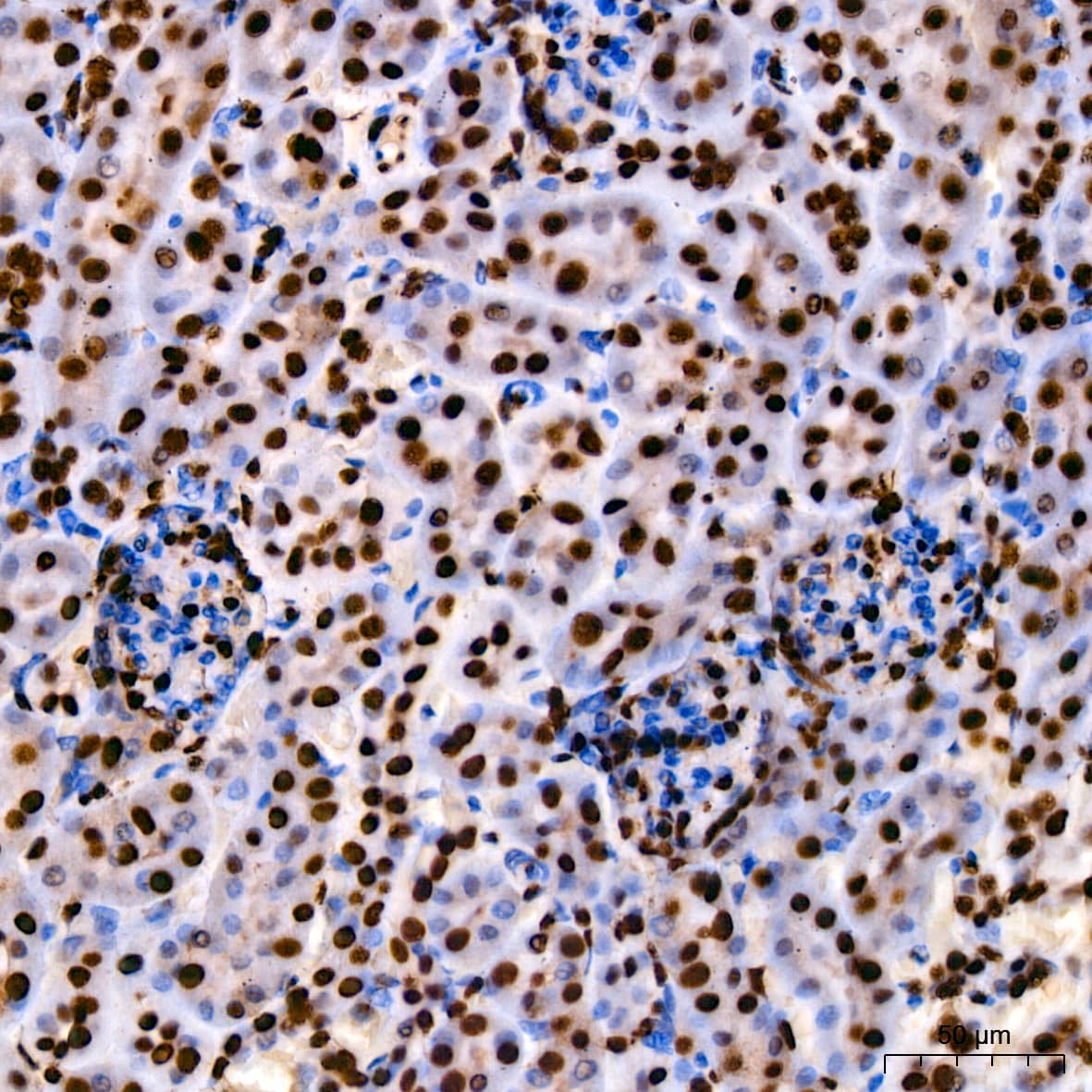 Immunohistochemistry: HMGB1/HMG-1 Antibody (1C4T5) [HMGB1/HMG-1] - Immunohistochemistry analysis of paraffin-embedded Mouse kidney using [KO Validated] HMGB1/HMG-1 Rabbit mAb  at dilution of 1:200 (40x lens). High pressure antigen retrieval performed with 0.01M Citrate Bufferr (pH 6.0) prior to IHC staining.