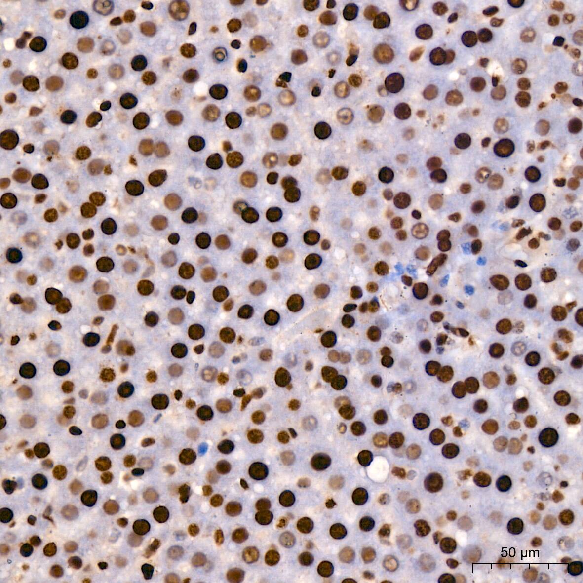 Immunohistochemistry: HMGB1/HMG-1 Antibody (1C4T5) [HMGB1/HMG-1] - Immunohistochemistry analysis of paraffin-embedded Rat liver using [KO Validated] HMGB1/HMG-1 Rabbit mAb  at dilution of 1:200 (40x lens). High pressure antigen retrieval performed with 0.01M Citrate Bufferr (pH 6.0) prior to IHC staining.