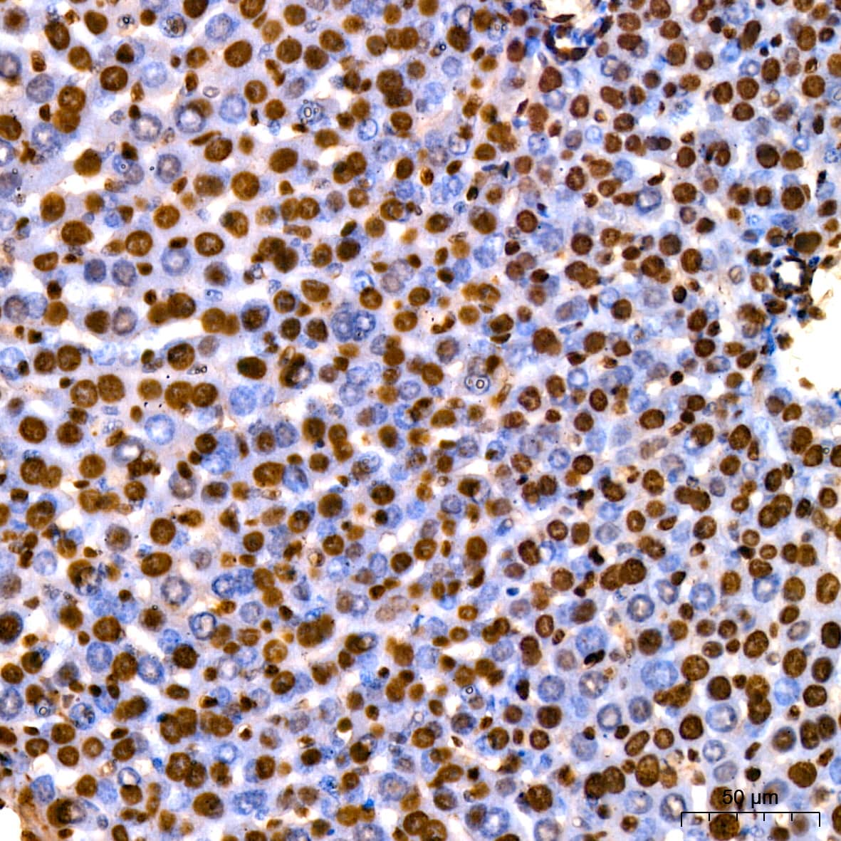 Immunohistochemistry: HMGB1/HMG-1 Antibody (1C4T5) [HMGB1/HMG-1] - Immunohistochemistry analysis of paraffin-embedded Mouse liver using [KO Validated] HMGB1/HMG-1 Rabbit mAb  at dilution of 1:200 (40x lens). High pressure antigen retrieval performed with 0.01M Citrate Bufferr (pH 6.0) prior to IHC staining.