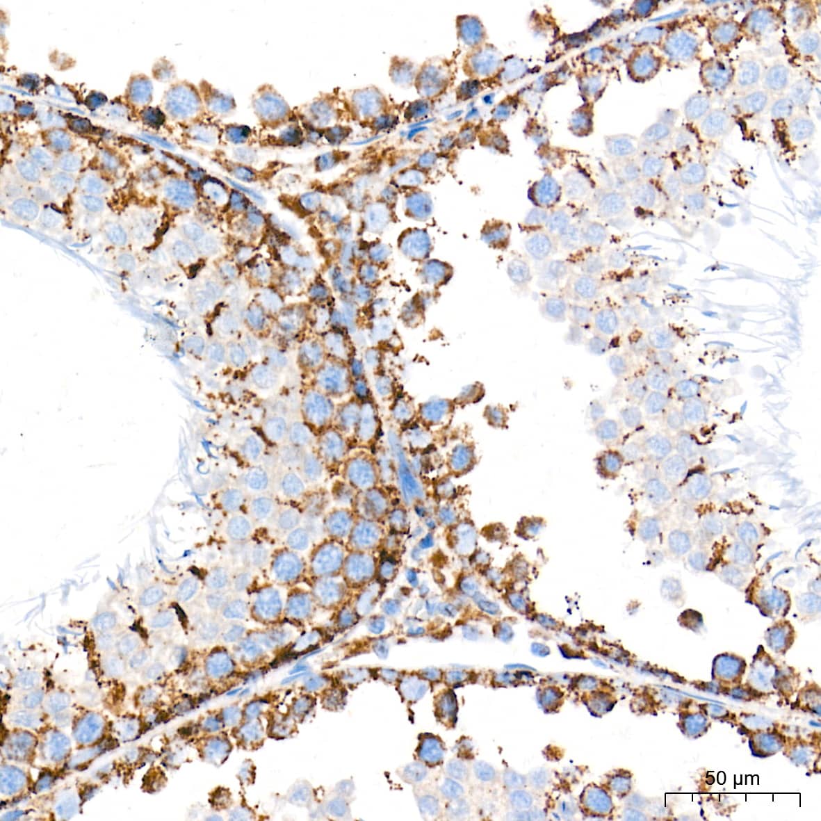 Immunohistochemistry: AIF Antibody (5F0Y1) [AIF] - Immunohistochemistry analysis of paraffin-embedded Rat testis tissue using AIF Rabbit mAb  at a dilution of 1:500 (40x lens). High pressure antigen retrieval performed with 0.01M Tris-EDTA Buffer (pH 9.0) prior to IHC staining.