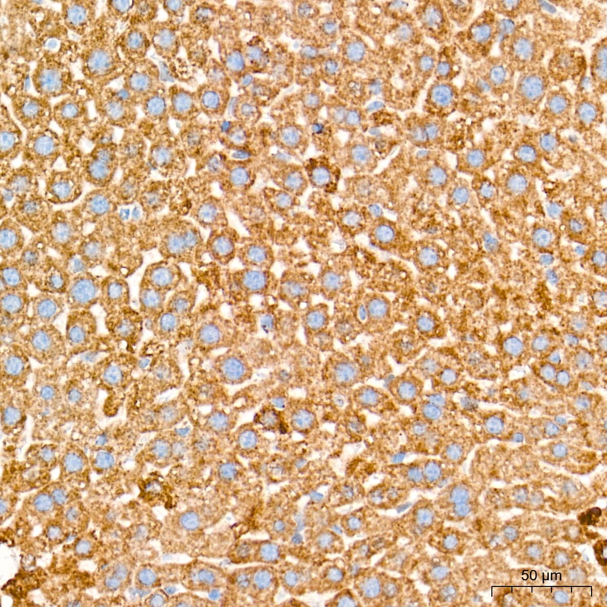 Immunohistochemistry: AIF Antibody (5F0Y1) [AIF] - Immunohistochemistry analysis of paraffin-embedded Mouse liver tissue using AIF Rabbit mAb  at a dilution of 1:500 (40x lens). High pressure antigen retrieval performed with 0.01M Tris-EDTA Buffer (pH 9.0) prior to IHC staining.