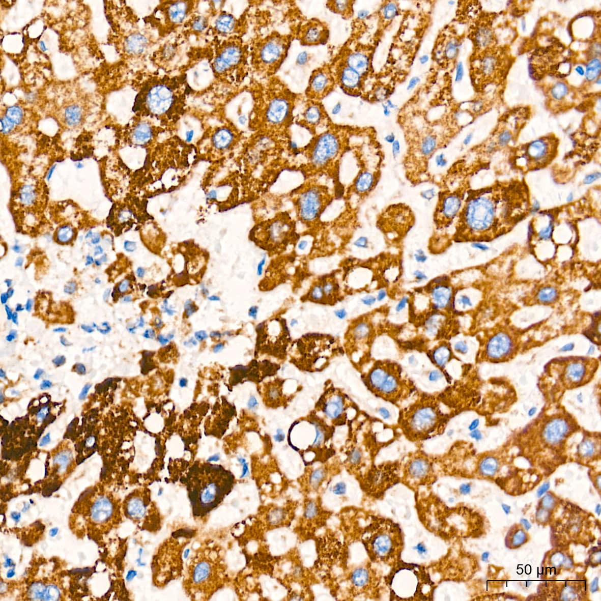 Immunohistochemistry: AIF Antibody (5F0Y1) [AIF] - Immunohistochemistry analysis of paraffin-embedded Human liver tissue using AIF Rabbit mAb  at a dilution of 1:500 (40x lens). High pressure antigen retrieval performed with 0.01M Tris-EDTA Buffer (pH 9.0) prior to IHC staining.