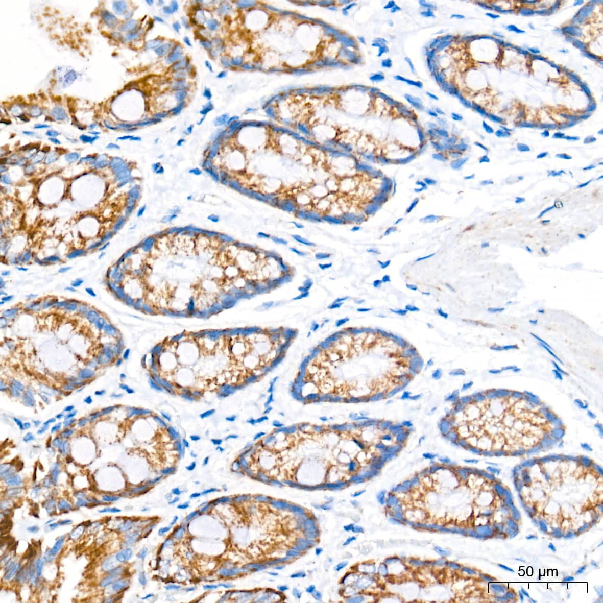 Immunohistochemistry: AIF Antibody (5F0Y1) [AIF] - Immunohistochemistry analysis of paraffin-embedded Rat colon tissue using AIF Rabbit mAb  at a dilution of 1:500 (40x lens). High pressure antigen retrieval performed with 0.01M Tris-EDTA Buffer (pH 9.0) prior to IHC staining.