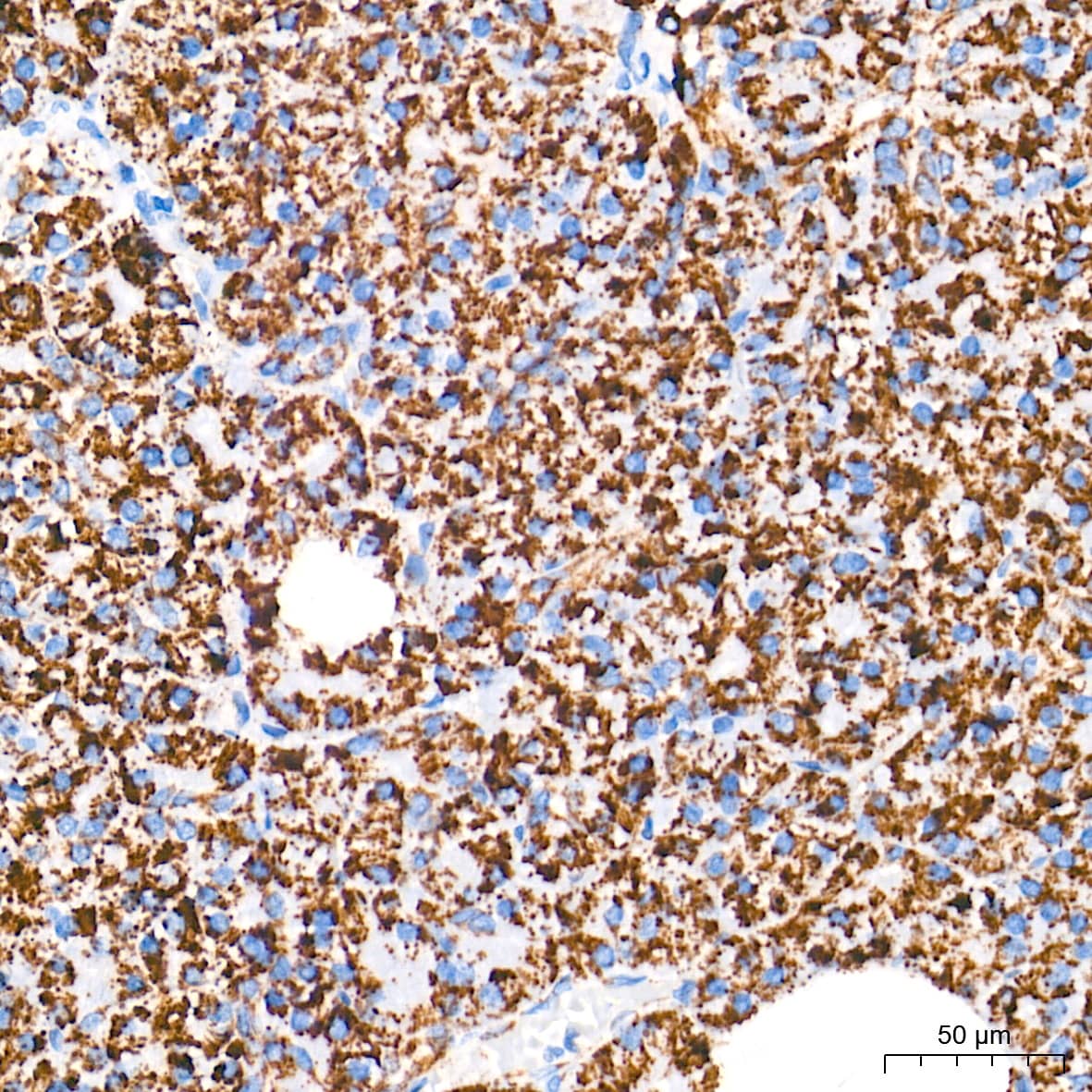 Immunohistochemistry: AIF Antibody (5F0Y1) [AIF] - Immunohistochemistry analysis of paraffin-embedded Human pancreas tissue using AIF Rabbit mAb  at a dilution of 1:500 (40x lens). High pressure antigen retrieval performed with 0.01M Tris-EDTA Buffer (pH 9.0) prior to IHC staining.