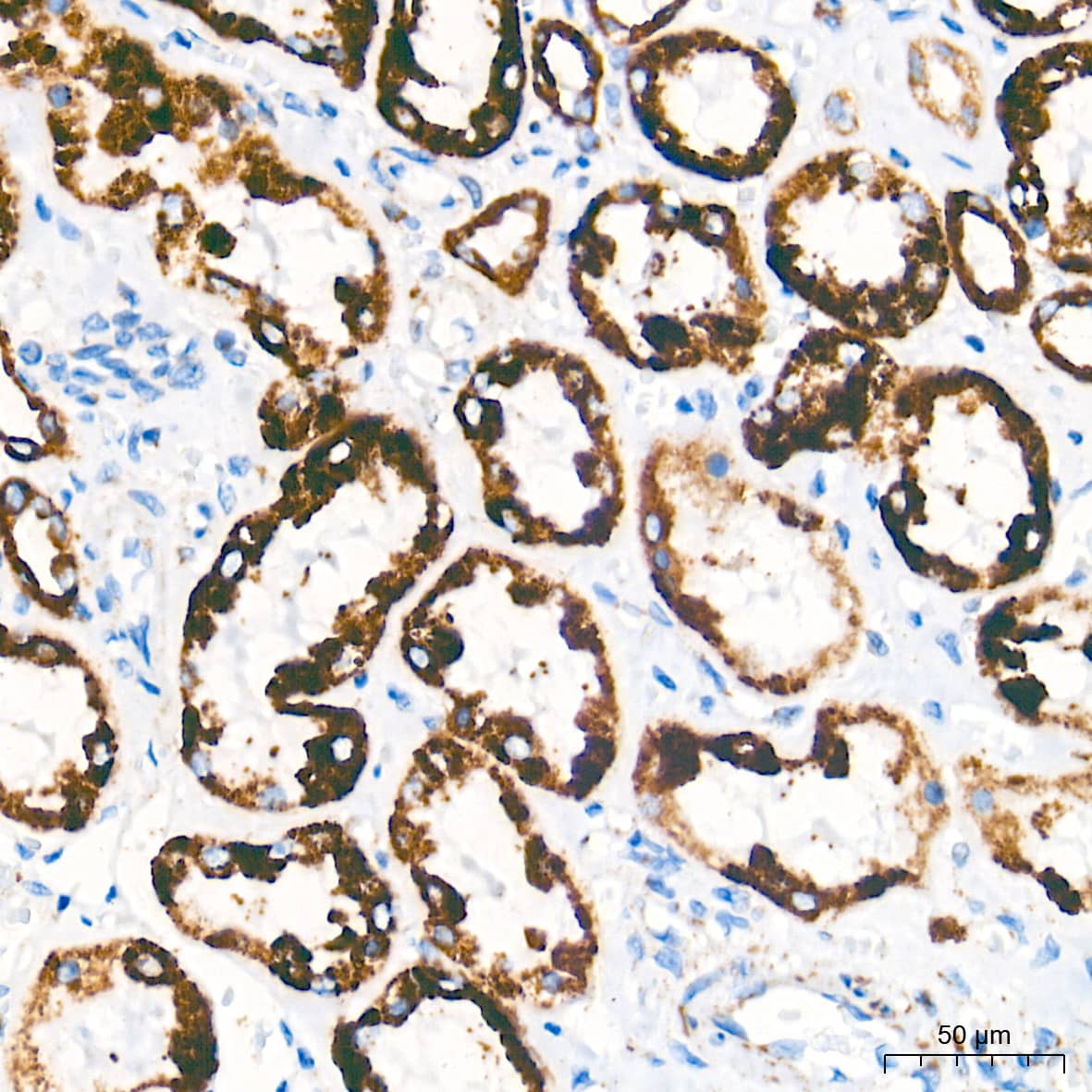 Immunohistochemistry: AIF Antibody (5F0Y1) [AIF] - Immunohistochemistry analysis of paraffin-embedded Human kidney tissue using AIF Rabbit mAb  at a dilution of 1:500 (40x lens). High pressure antigen retrieval performed with 0.01M Tris-EDTA Buffer (pH 9.0) prior to IHC staining.