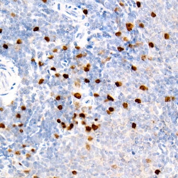 Immunohistochemistry: Aurora B Antibody (3C4V8) [Aurora B] - Immunohistochemistry analysis of paraffin-embedded Rat spleen tissue using Aurora B Rabbit mAb  at a dilution of 1:500 (40x lens). High pressure antigen retrieval performed with 0.01M Citrate Bufferr (pH 6.0) prior to IHC staining.