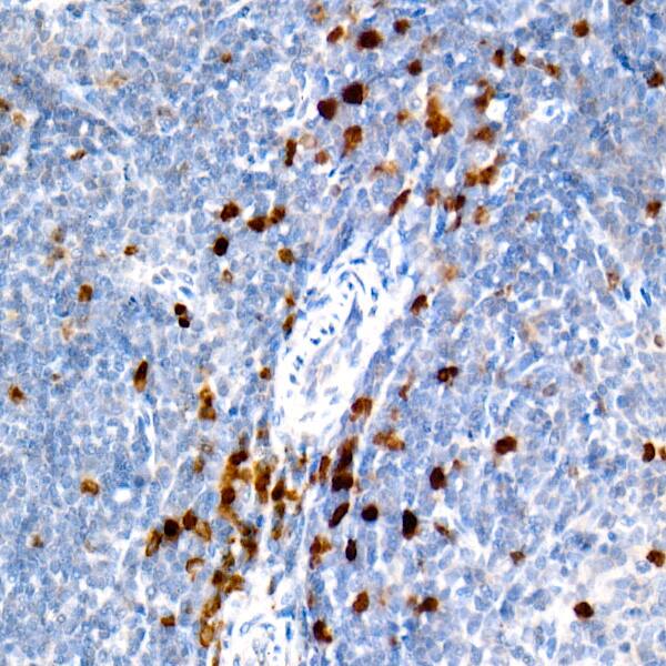 Immunohistochemistry: Aurora B Antibody (3C4V8) [Aurora B] - Immunohistochemistry analysis of paraffin-embedded Mouse spleen tissue using Aurora B Rabbit mAb  at a dilution of 1:500 (40x lens). High pressure antigen retrieval performed with 0.01M Citrate Bufferr (pH 6.0) prior to IHC staining.