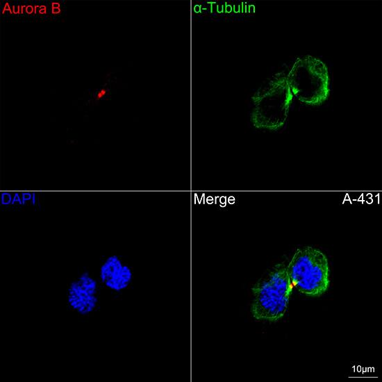 Immunocytochemistry/ Immunofluorescence: Aurora B Antibody (3C4V8) [Aurora B] - Confocal imaging of A-431 cells using Aurora B Rabbit mAb  followed by a further incubation with Cy3 Goat Anti-Rabbit IgG (H+L)  . The cells were counterstained with alpha-Tubulin Mouse mAb  followed by incubation with ABflo 488-conjugated Goat Anti-Mouse IgG (H+L) Ab  (Green). DAPI was used for nuclear staining (Blue). Objective: 100x.