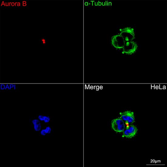 Immunocytochemistry/ Immunofluorescence: Aurora B Antibody (3C4V8) [Aurora B] - Confocal imaging of HeLa cells using Aurora B Rabbit mAb  followed by a further incubation with Cy3 Goat Anti-Rabbit IgG (H+L)  . The cells were counterstained with alpha-Tubulin Mouse mAb  followed by incubation with ABflo 488-conjugated Goat Anti-Mouse IgG (H+L) Ab  (Green). DAPI was used for nuclear staining (Blue). Objective: 100x.