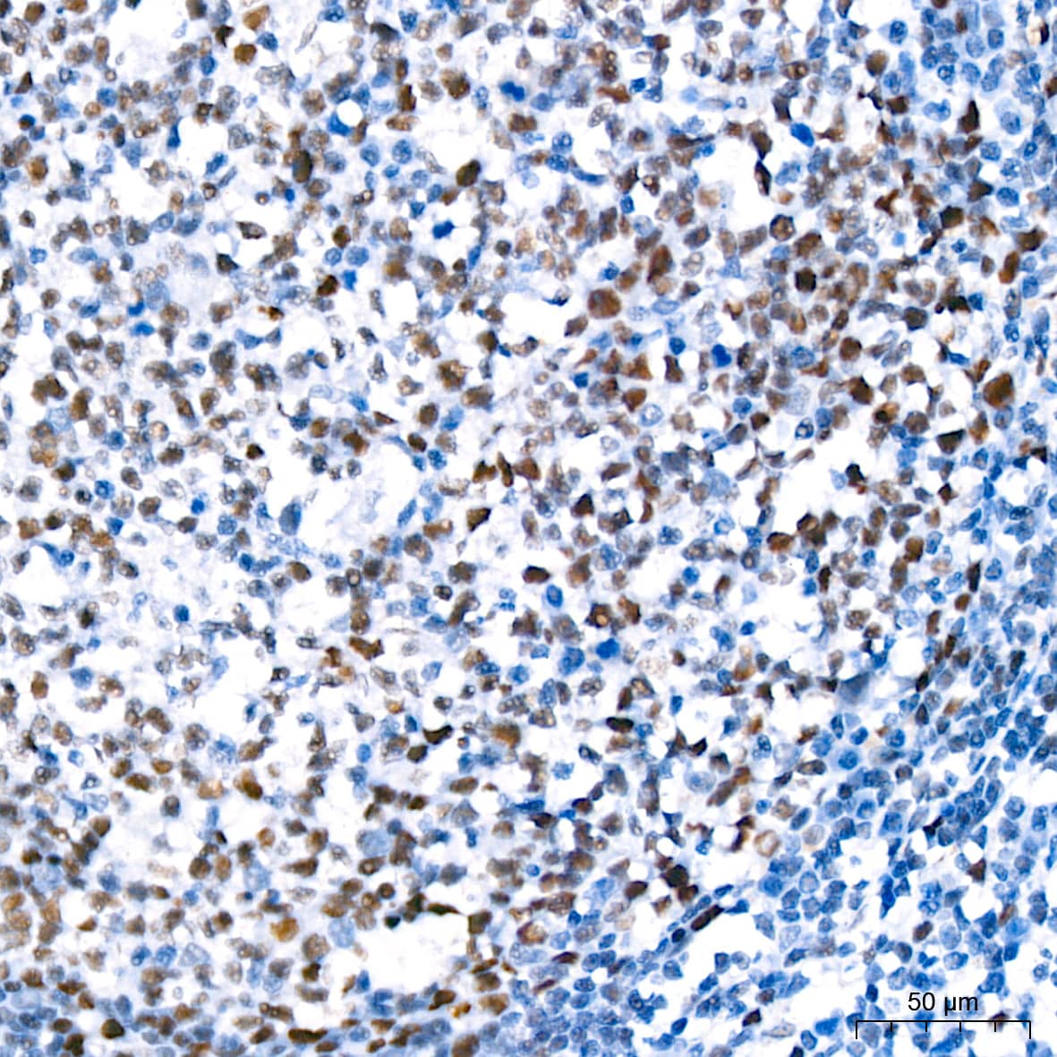 Immunohistochemistry: TCF7L2 Antibody (1W10T6) [TCF7L2] - Immunohistochemistry analysis of paraffin-embedded Human tonsil tissue using TCF7L2 Rabbit mAb  at a dilution of 1:200 (40x lens). High pressure antigen retrieval performed with 0.01M Citrate Bufferr (pH 6.0) prior to IHC staining.