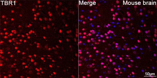 Immunocytochemistry/ Immunofluorescence: TBR1 Antibody (1U1K5) [NBP3-15769] - Confocal imaging of paraffin-embedded Mouse brain using TBR1 Rabbit mAb  followed by a further incubation with Cy3 Goat Anti-Rabbit IgG (H+L)  . DAPI was used for nuclear staining (Blue). Objective: 40x. Perform microwave antigen retrieval with 0.01 M citrate buffer (pH 6.0) prior to IF staining.