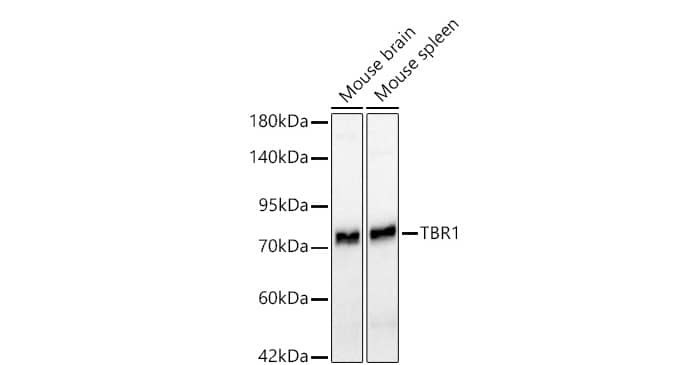 Analysis of various lysates using TBR1 Rabbit mAb at 1:1000 dilution incubated overnight at 4℃.Secondary antibody: HRP-conjugated Goat anti-Rabbit IgG (H+L) at 1:10000 dilution.Lysates/proteins: 25 μg per lane.Blocking buffer: 3% nonfat dry milk in TBST.Detection: ECL Basic Kit.Exposure time: 
