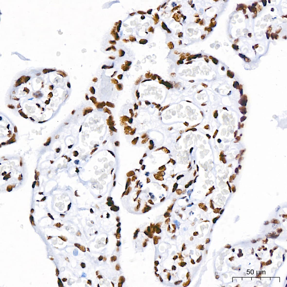 Immunohistochemistry: Brg1 Antibody (4N9C4) [Brg1] - Immunohistochemistry analysis of paraffin-embedded Human placenta using Brg1 Rabbit mAb  at dilution of 1:100 (40x lens). High pressure antigen retrieval performed with 0.01M Tris/EDTA Buffer (pH 9.0) prior to IHC staining.