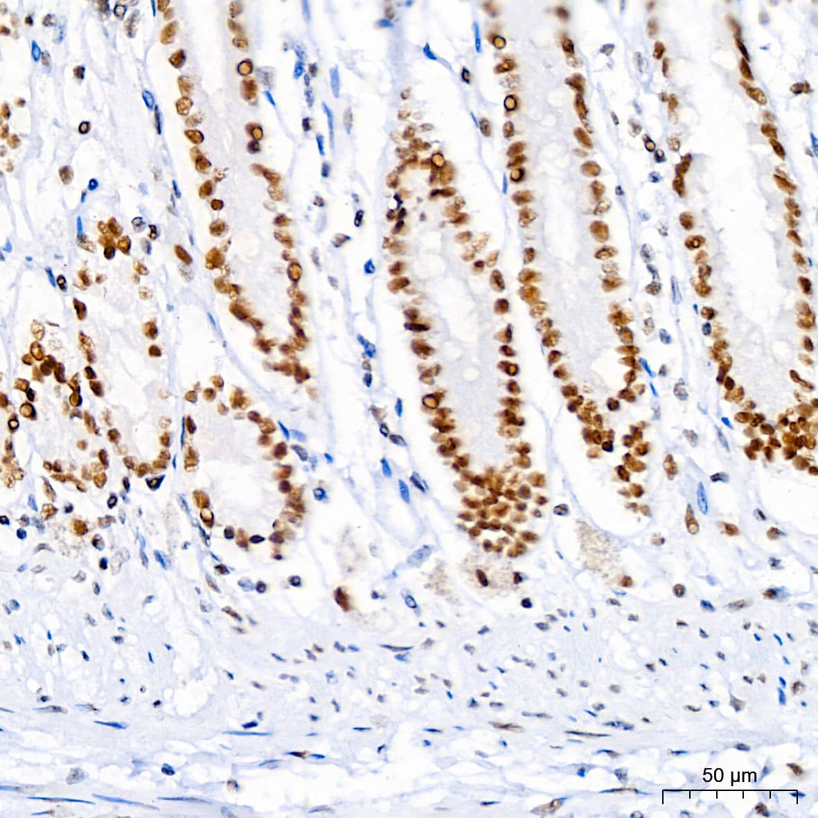 Immunohistochemistry: Brg1 Antibody (4N9C4) [Brg1] - Immunohistochemistry analysis of paraffin-embedded Human colon using Brg1 Rabbit mAb  at dilution of 1:100 (40x lens). High pressure antigen retrieval performed with 0.01M Tris/EDTA Buffer (pH 9.0) prior to IHC staining.