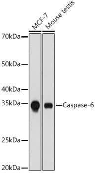 Western Blot: Caspase-6 Antibody (2W4G2) [NBP3-15775] - Western blot analysis of extracts of various cell lines, using Caspase-6 antibody  at 1:1000 dilution.Secondary antibody: HRP Goat Anti-Rabbit IgG (H+L)  at 1:10000 dilution.Lysates/proteins: 25ug per lane.Blocking buffer: 3% nonfat dry milk in TBST.Detection: ECL Basic Kit .Exposure time: 3min.
