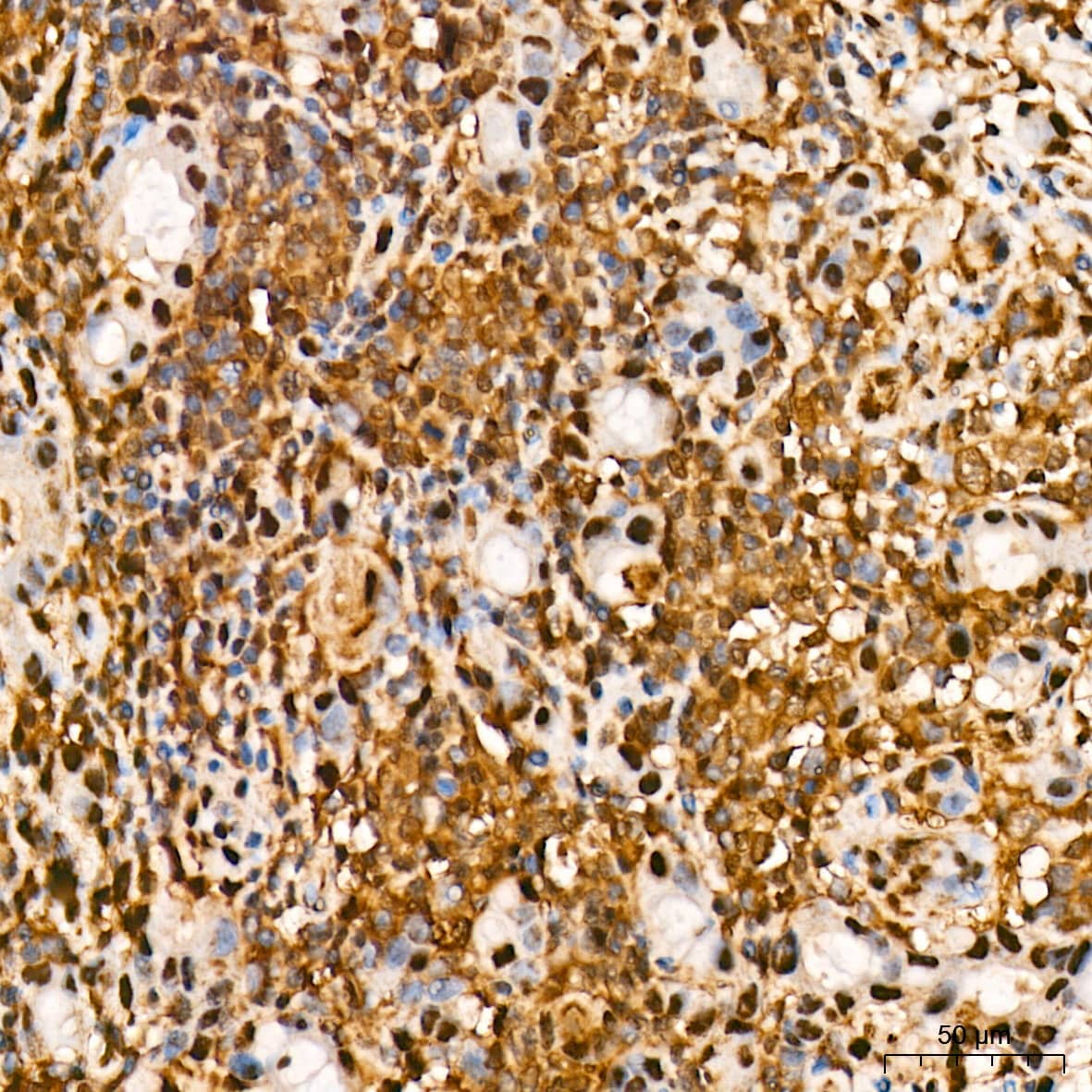 Immunohistochemistry: ERK1 Antibody (0B0C1) [ERK1] - Immunohistochemistry analysis of paraffin-embedded Human breast tissue using [KD Validated] ERK1 Rabbit mAb  at a dilution of 1:200 (40x lens). High pressure antigen retrieval was performed with 0.01 M citrate buffer (pH 6.0) prior to IHC staining.