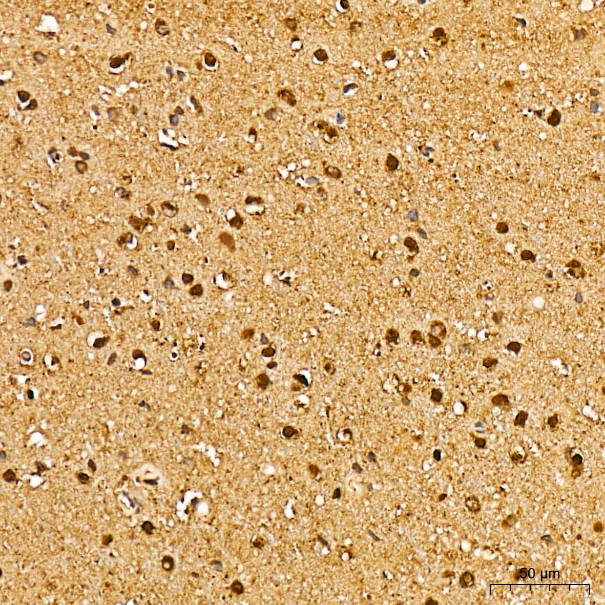 Immunohistochemistry: ERK1 Antibody (0B0C1) [ERK1] - Immunohistochemistry analysis of paraffin-embedded Human brain tissue using [KD Validated] ERK1 Rabbit mAb  at a dilution of 1:200 (40x lens). High pressure antigen retrieval was performed with 0.01 M citrate buffer (pH 6.0) prior to IHC staining.