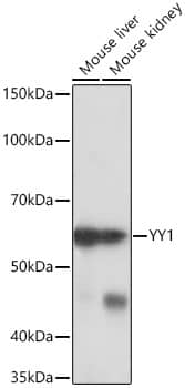 Western Blot: YY1 Antibody (6J6L1) [YY1] - Western blot analysis of various lysates using YY1 Rabbit mAb  at 1:1000 dilution.Secondary antibody: HRP-conjugated Goat anti-Rabbit IgG (H+L)  at 1:10000 dilution.Lysates/proteins: 25ug per lane.Blocking buffer: 3% nonfat dry milk in TBST.Detection: ECL Basic Kit .Exposure time: 10s.