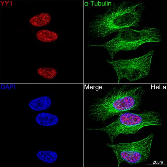 Immunocytochemistry/ Immunofluorescence: YY1 Antibody (6J6L1) [YY1] - Confocal imaging of HeLa cells using YY1 Rabbit mAb . The cells were counterstained with alpha-Tubulin Mouse mAb  (Green). DAPI was used for nuclear staining (blue). Objective: 100x.