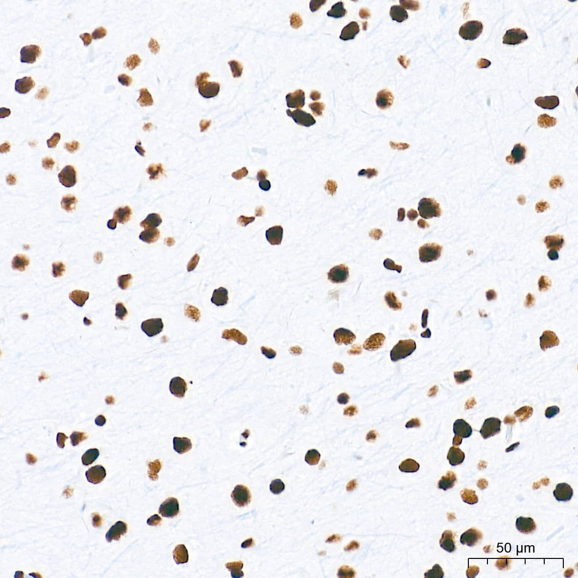 Immunohistochemistry: HDAC1 Antibody (2L6O7) [HDAC1] - Immunohistochemistry analysis of paraffin-embedded Rat brain tissue using [KO Validated] HDAC1 Rabbit mAb  at a dilution of 1:2000 (40x lens). High pressure antigen retrieval performed with 0.01M Tris-EDTA Buffer (pH 9.0) prior to IHC staining.