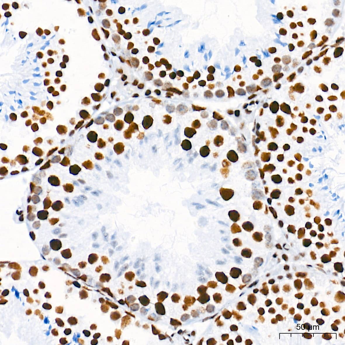 Immunohistochemistry: HDAC1 Antibody (2L6O7) [HDAC1] - Immunohistochemistry analysis of paraffin-embedded Mouse testis tissue using [KO Validated] HDAC1 Rabbit mAb  at a dilution of 1:2000 (40x lens). High pressure antigen retrieval performed with 0.01M Tris-EDTA Buffer (pH 9.0) prior to IHC staining.