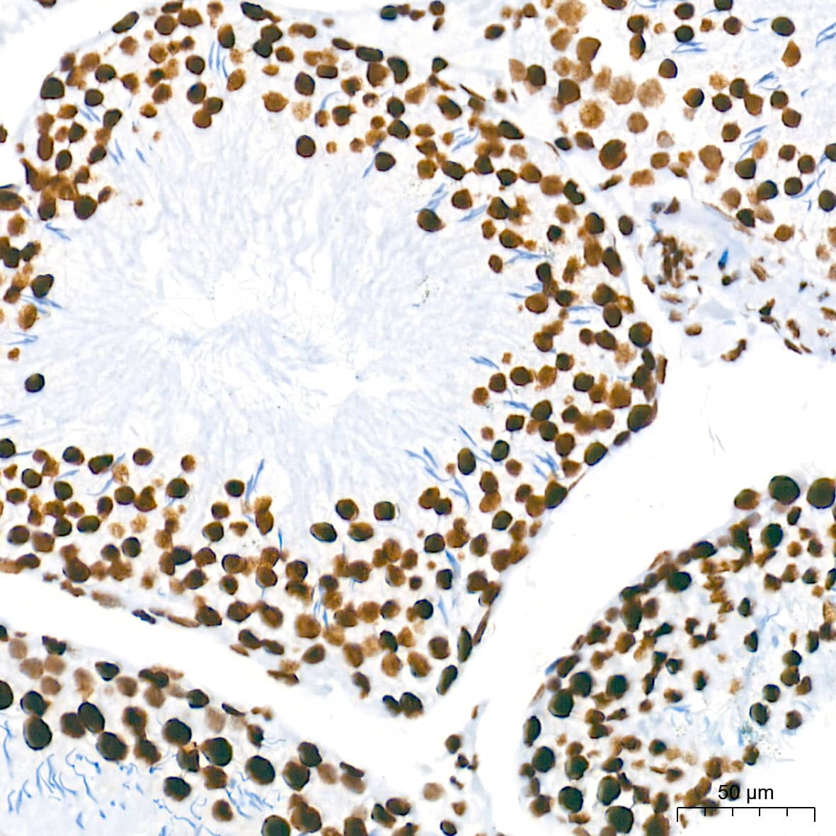 Immunohistochemistry: HDAC1 Antibody (2L6O7) [HDAC1] - Immunohistochemistry analysis of paraffin-embedded Rat testis tissue using [KO Validated] HDAC1 Rabbit mAb  at a dilution of 1:2000 (40x lens). High pressure antigen retrieval performed with 0.01M Tris-EDTA Buffer (pH 9.0) prior to IHC staining.