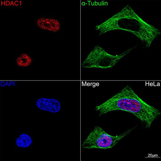 Immunocytochemistry/ Immunofluorescence: HDAC1 Antibody (2L6O7) [HDAC1] - Confocal imaging of HeLa cells using [KO Validated] HDAC1 Rabbit mAb . The cells were counterstained with alpha-Tubulin Mouse mAb  (Green). DAPI was used for nuclear staining (blue). Objective: 100x.