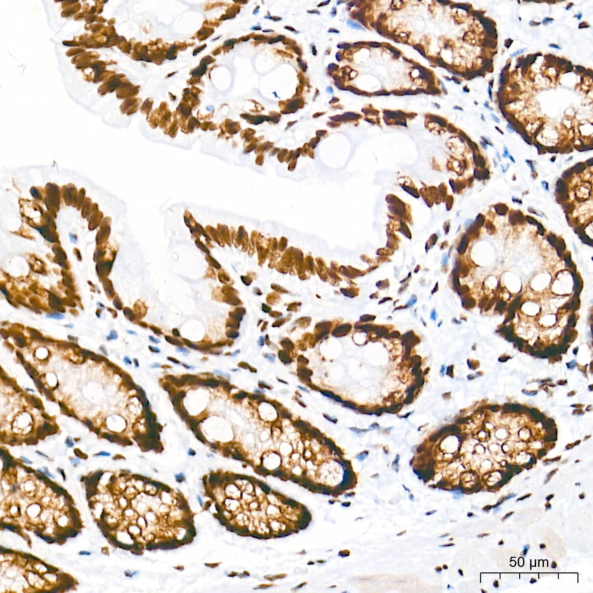 Immunohistochemistry: HDAC1 Antibody (2L6O7) [HDAC1] - Immunohistochemistry analysis of paraffin-embedded Rat colon tissue using [KO Validated] HDAC1 Rabbit mAb  at a dilution of 1:2000 (40x lens). High pressure antigen retrieval performed with 0.01M Tris-EDTA Buffer (pH 9.0) prior to IHC staining.