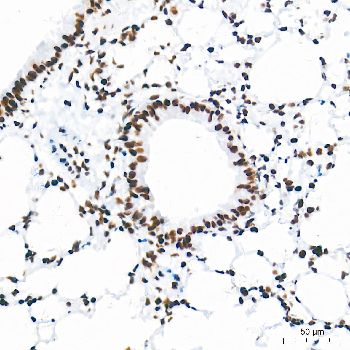 Immunohistochemistry: HDAC1 Antibody (2L6O7) [HDAC1] - Immunohistochemistry analysis of paraffin-embedded Mouse lung tissue using [KO Validated] HDAC1 Rabbit mAb  at a dilution of 1:2000 (40x lens). High pressure antigen retrieval performed with 0.01M Tris-EDTA Buffer (pH 9.0) prior to IHC staining.