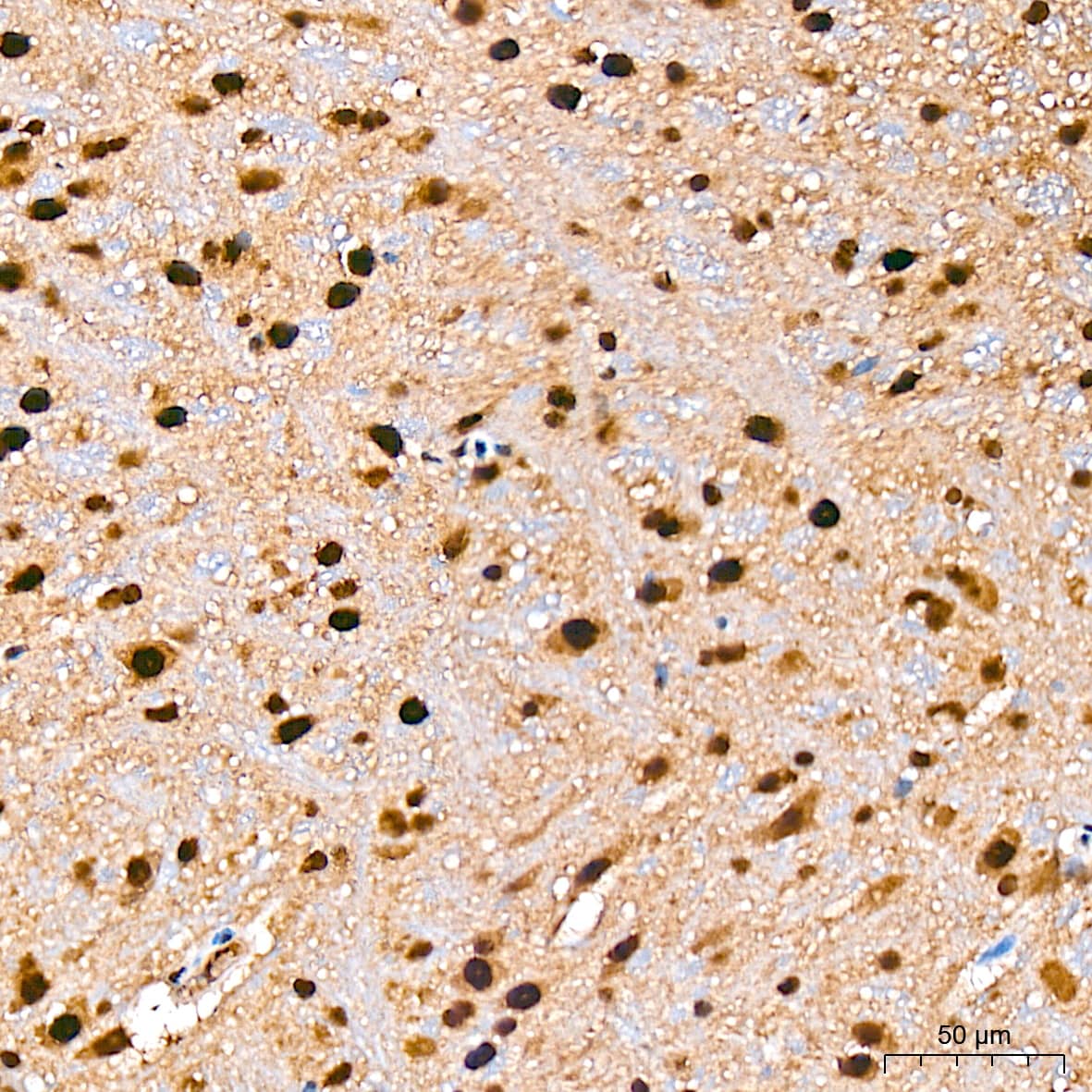 Immunohistochemistry: COP9 Antibody (7V1L8) [COP9] - Immunohistochemistry analysis of paraffin-embedded Mouse brain tissue using COP9 Rabbit mAb  at a dilution of 1:200 (40x lens). High pressure antigen retrieval was performed with 0.01 M citrate buffer (pH 6.0) prior to IHC staining.