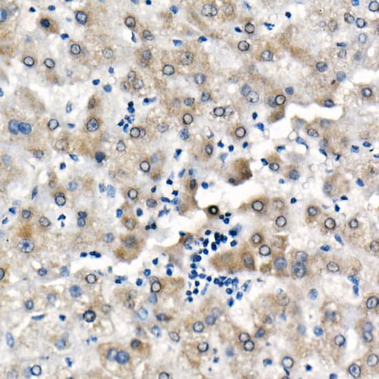 <b>Biological Strategies Validation. </b>Immunohistochemistry: BNIP3 Antibody (2P7B8) [BNIP3] - Immunohistochemistry analysis of paraffin-embedded Human liver using BNIP3 Rabbit mAb  at dilution of 1:500 (40x lens). High pressure antigen retrieval performed with 0.01M Citrate Bufferr (pH 6.0) prior to IHC staining.