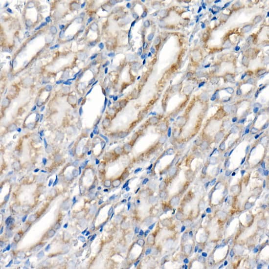 Immunohistochemistry: BNIP3 Antibody (2P7B8) [BNIP3] - Immunohistochemistry analysis of paraffin-embedded Rat kidney using BNIP3 Rabbit mAb  at dilution of 1:500 (40x lens). High pressure antigen retrieval performed with 0.01M Citrate Bufferr (pH 6.0) prior to IHC staining.