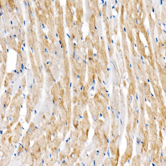 Immunohistochemistry: BNIP3 Antibody (2P7B8) [BNIP3] - Immunohistochemistry analysis of paraffin-embedded Rat heart using BNIP3 Rabbit mAb  at dilution of 1:500 (40x lens). High pressure antigen retrieval performed with 0.01M Citrate Bufferr (pH 6.0) prior to IHC staining.