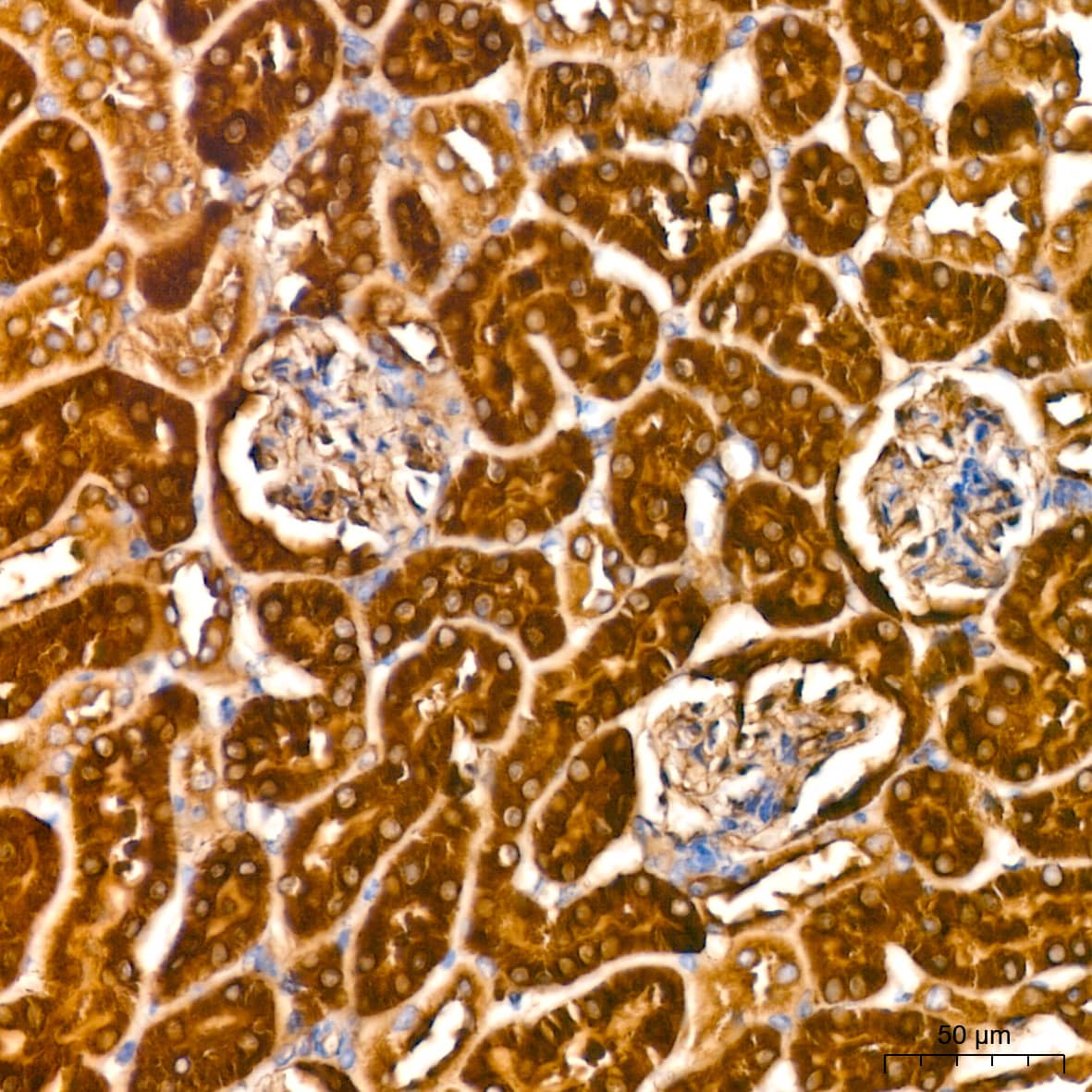 Immunohistochemistry: ATG3/APG3 Antibody (5D2W0) [ATG3/APG3] - Immunohistochemistry analysis of paraffin-embedded Mouse kidney tissue using ATG3/APG3 Rabbit mAb  at a dilution of 1:200 (40x lens). High pressure antigen retrieval performed with 0.01M Tris-EDTA Buffer (pH 9.0) prior to IHC staining.