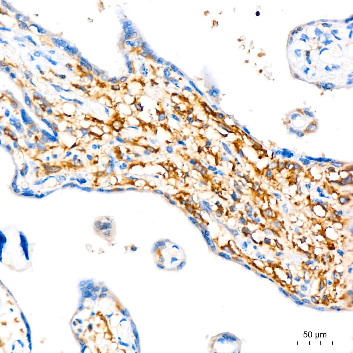 Immunohistochemistry: ATG3/APG3 Antibody (5D2W0) [ATG3/APG3] - Immunohistochemistry analysis of paraffin-embedded Human placenta tissue using ATG3/APG3 Rabbit mAb  at a dilution of 1:200 (40x lens). High pressure antigen retrieval performed with 0.01M Citrate Bufferr (pH 6.0) prior to IHC staining.