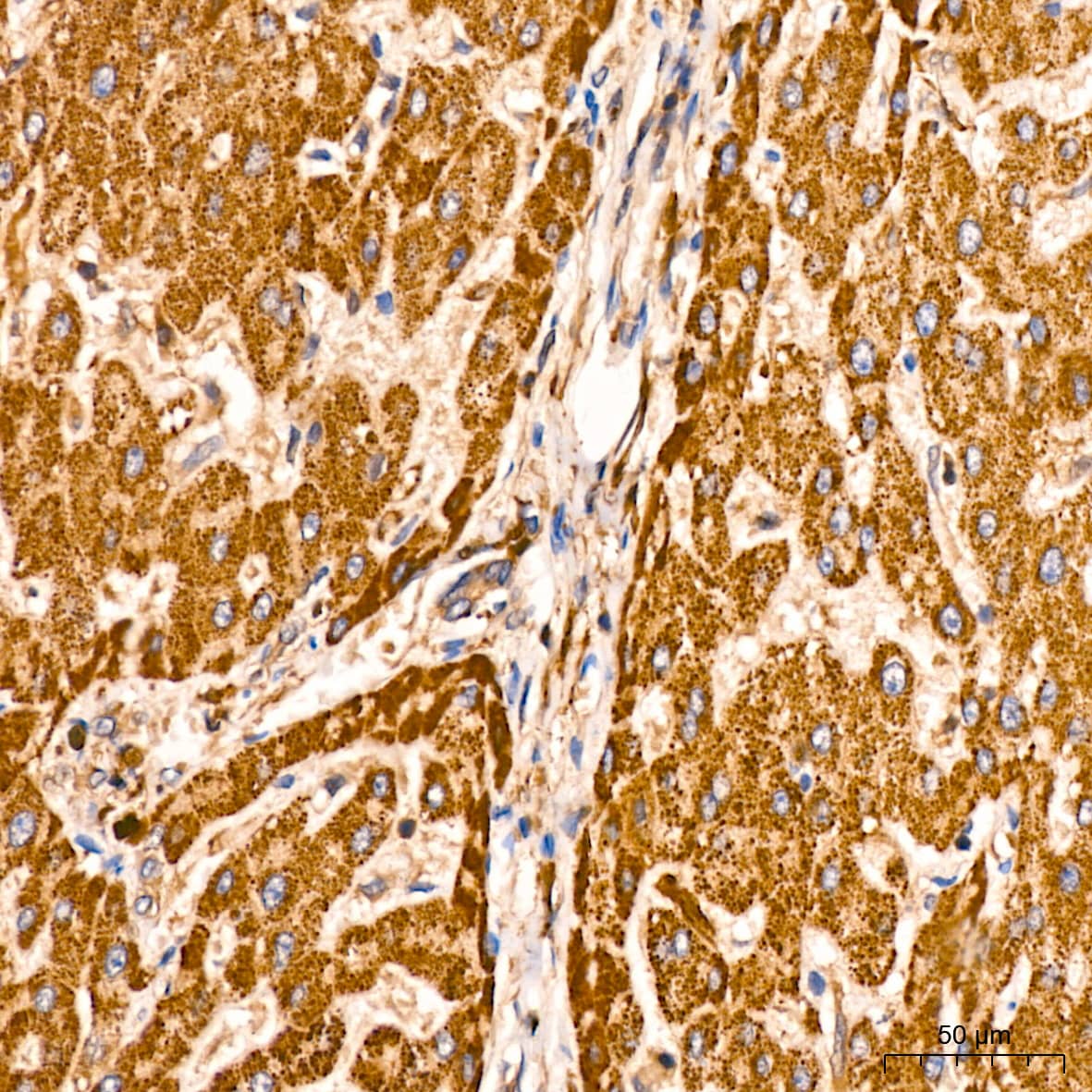 Immunohistochemistry: ATG3/APG3 Antibody (5D2W0) [ATG3/APG3] - Immunohistochemistry analysis of paraffin-embedded Human liver tissue using ATG3/APG3 Rabbit mAb  at a dilution of 1:200 (40x lens). High pressure antigen retrieval performed with 0.01M Tris-EDTA Buffer (pH 9.0) prior to IHC staining.