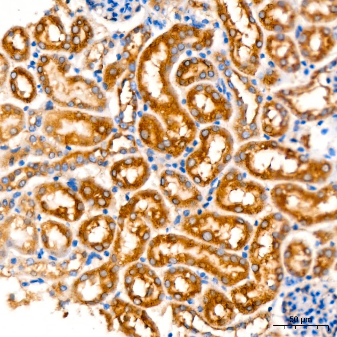 Immunohistochemistry: ATG3/APG3 Antibody (5D2W0) [ATG3/APG3] - Immunohistochemistry analysis of paraffin-embedded Mouse kidney tissue using ATG3/APG3 Rabbit mAb  at a dilution of 1:200 (40x lens). High pressure antigen retrieval performed with 0.01M Citrate Bufferr (pH 6.0) prior to IHC staining.