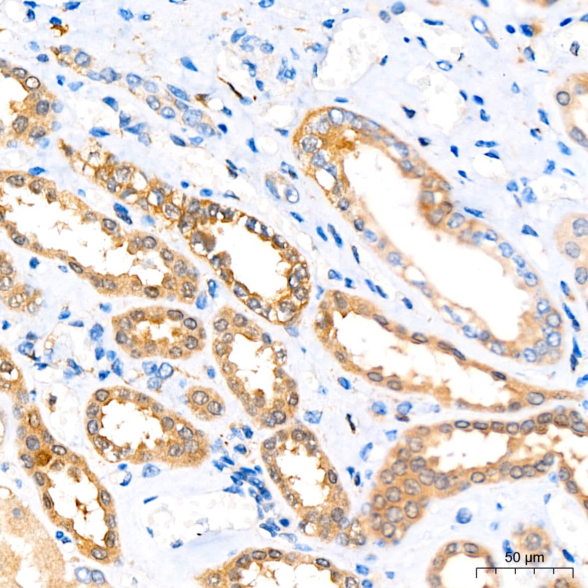 Immunohistochemistry: ATG3/APG3 Antibody (5D2W0) [ATG3/APG3] - Immunohistochemistry analysis of paraffin-embedded Human kidney tissue using ATG3/APG3 Rabbit mAb  at a dilution of 1:200 (40x lens). High pressure antigen retrieval performed with 0.01M Citrate Bufferr (pH 6.0) prior to IHC staining.